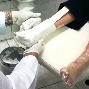ortopel tratamento de pés diabéticos