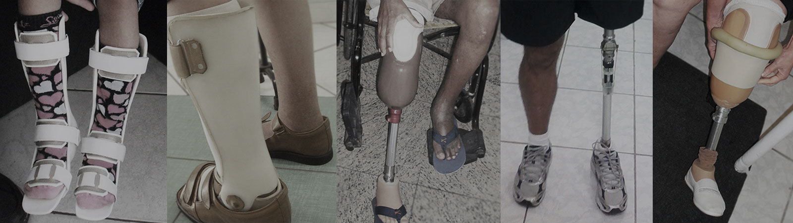 Clínica de ortopedia técnica confecção de próteses e órteses em santos