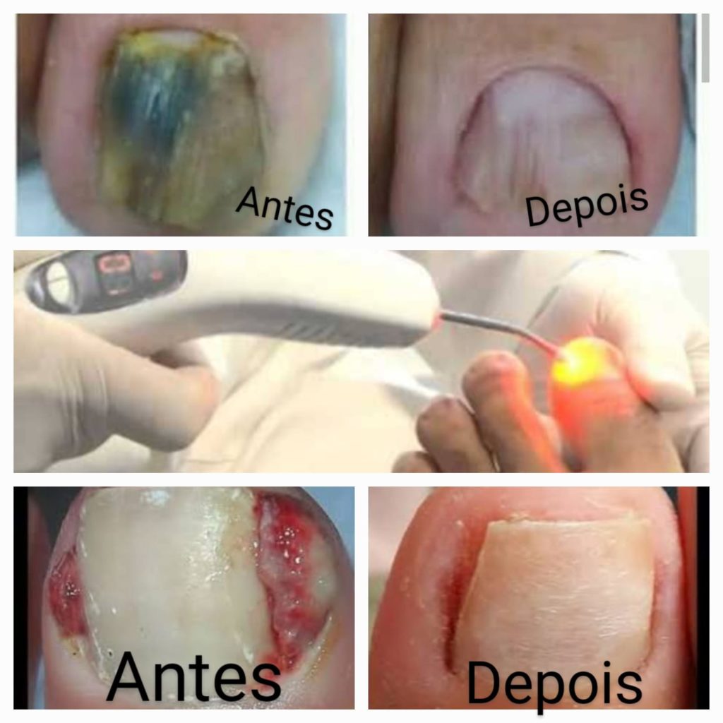 Ortopel Santos - Clínica Ortopedia e Podologia
