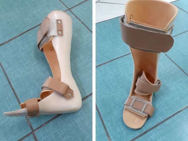 órteses sob medida Ortopel Santos